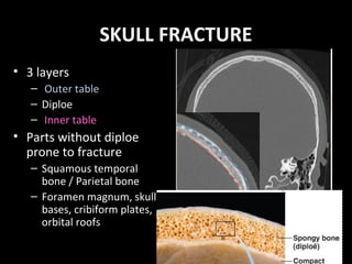 SKULL FRACTURE
• 3 layers
– Outer table
– Diploe
– Inner table
• Parts without diploe
prone to fracture
– Squamous temporal
bone / Parietal bone
– Foramen magnum, skull
bases, cribiform plates,
orbital roofs
 