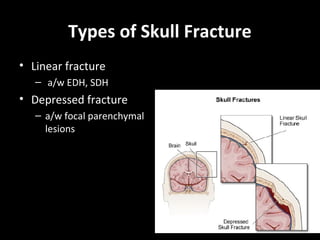 Types of Skull Fracture
• Linear fracture
– a/w EDH, SDH
• Depressed fracture
– a/w focal parenchymal
lesions
 