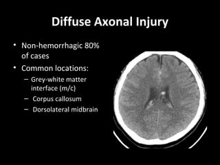 Diffuse Axonal Injury
• Non-hemorrhagic 80%
of cases
• Common locations:
– Grey-white matter
interface (m/c)
– Corpus callosum
– Dorsolateral midbrain
 
