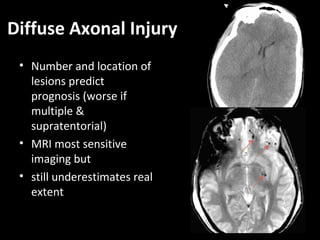 Diffuse Axonal Injury
• Number and location of
lesions predict
prognosis (worse if
multiple &
supratentorial)
• MRI most sensitive
imaging but
• still underestimates real
extent
 