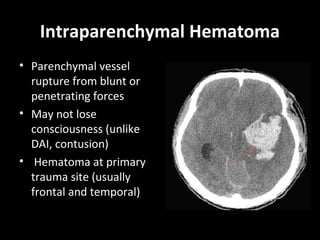 Intraparenchymal Hematoma
• Parenchymal vessel
rupture from blunt or
penetrating forces
• May not lose
consciousness (unlike
DAI, contusion)
• Hematoma at primary
trauma site (usually
frontal and temporal)
 