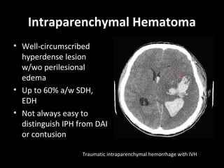 Intraparenchymal Hematoma
• Well-circumscribed
hyperdense lesion
w/wo perilesional
edema
• Up to 60% a/w SDH,
EDH
• Not always easy to
distinguish IPH from DAI
or contusion
Traumatic intraparenchymal hemorrhage with IVH
 