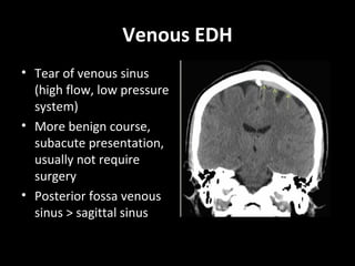 Venous EDH
• Tear of venous sinus
(high flow, low pressure
system)
• More benign course,
subacute presentation,
usually not require
surgery
• Posterior fossa venous
sinus > sagittal sinus
 