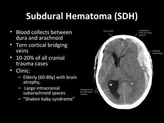 Subdural Hematoma (SDH)
• Blood collects between
dura and arachnoid
• Torn cortical bridging
veins
• 10-20% of all cranial
trauma cases
• Clinic:
– Elderly (60-80y) with brain
atrophy,
– Large intracranial
subarachnoid spaces
– “Shaken baby syndrome”
 