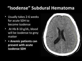 “Isodense” Subdural Hematoma
• Usually takes 2-6 weeks
for acute SDH to
become isodense
• At Hb 8-10 g/dL, blood
will be isodense to grey
matter
• • Anemic patients can
present with acute
isodense SDH
 