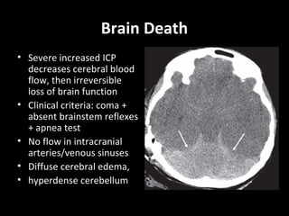Brain Death
• Severe increased ICP
decreases cerebral blood
flow, then irreversible
loss of brain function
• Clinical criteria: coma +
absent brainstem reflexes
+ apnea test
• No flow in intracranial
arteries/venous sinuses
• Diffuse cerebral edema,
• hyperdense cerebellum
 