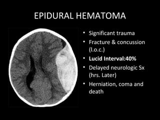 EPIDURAL HEMATOMA
• Significant trauma
• Fracture & concussion
(l.o.c.)
• Lucid Interval:40%
• Delayed neurologic Sx
(hrs. Later)
• Herniation, coma and
death
 