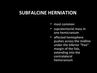 SUBFALCINE HERNIATION
• most common
• supratentorial mass in
one hemicranium
• affected hemisphere
pushes across the midline
under the inferior "free"
margin of the falx,
extending into the
contralateral
hemicranium
 