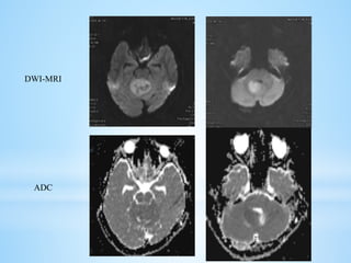 DWI-MRI
ADC
 