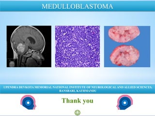 Thank you

NATIONAL INSTITUTE OF NEUROLOGICAL AND ALLIED SCIENCES, BANSBARI, KATHMANDU
MEDULLOBLASTOMA
UPENDRA DEVKOTA MEMORIAL NATIONAL INSTITUTE OF NEUROLOGICALAND ALLIED SCIENCES,
BANSBARI, KATHMANDU
 