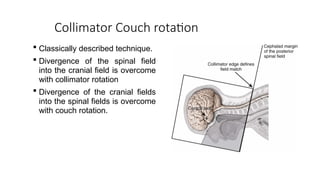 Medulloblastoma ANATOMY TO MANAGEMENT WITH RADIOTHERAPY TECHNIQUES | PPTX
