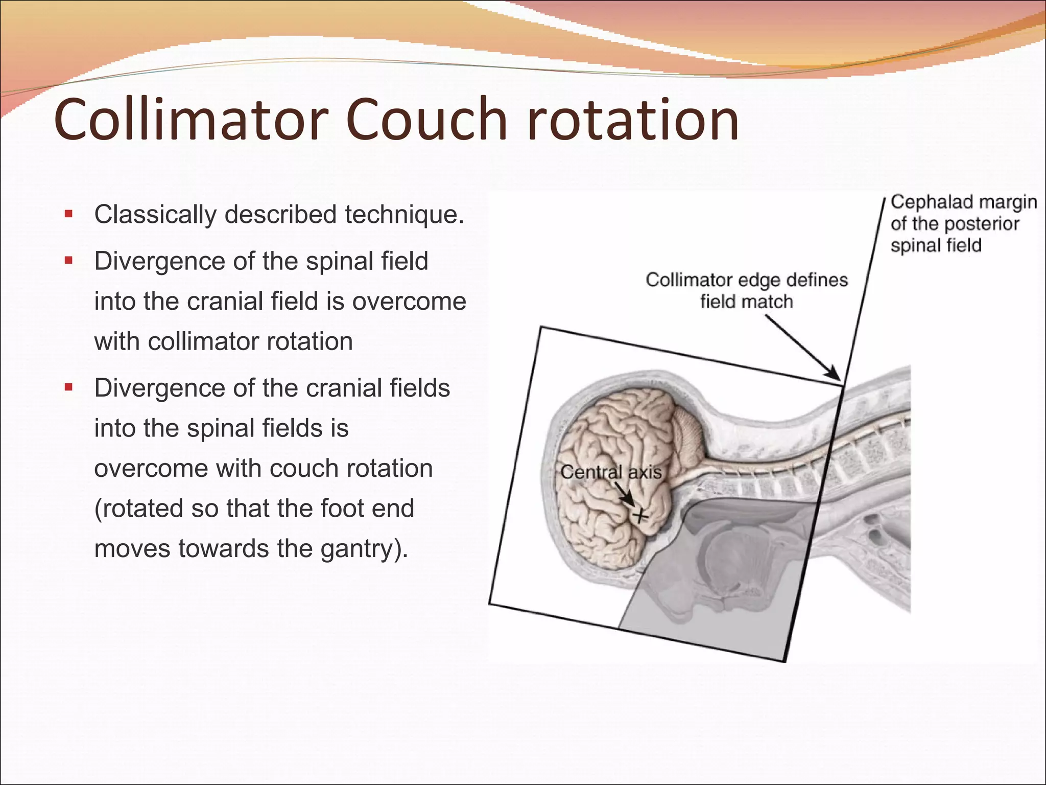 Diagnosis, Treatment & Management of Medulloblastoma | PPT