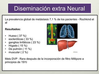 Diseminación extra Neural
La prevalencia global de metástasis 7,1 % de los pacientes - Rochkind et
al
Resultados:
• Hueso ( 37 %)
• escleróticas ( 33 %)
• ganglios linfáticos ( 23 %)
• Hígado ( 15 %)
• De pulmón ( 11 %)
• muscular ( 2 %)
Mets DVP : Rara después de la incorporación de filtro Millipore a
principios de 1970
 