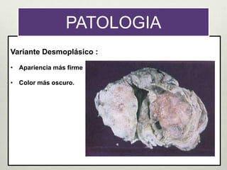 Variante Desmoplásico :
• Apariencia más firme
• Color más oscuro.
PATOLOGIA
 