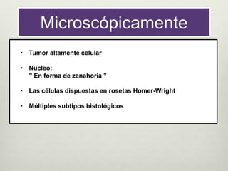 Microscópicamente
• Tumor altamente celular
• Nucleo:
" En forma de zanahoria ”
• Las células dispuestas en rosetas Homer-Wright
• Múltiples subtipos histológicos
 