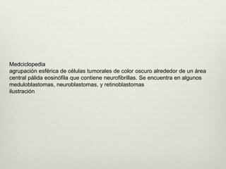 Medciclopedia
agrupación esférica de células tumorales de color oscuro alrededor de un área
central pálida eosinófila que contiene neurofibrillas. Se encuentra en algunos
meduloblastomas, neuroblastomas, y retinoblastomas
ilustración
 