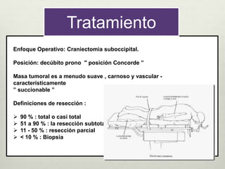 Tratamiento
Enfoque Operativo: Craniectomia suboccipital.
Posición: decúbito prono " posición Concorde ”
Masa tumoral es a menudo suave , carnoso y vascular -
característicamente
” succionable ”
Definiciones de resección :
 90 % : total o casi total
 51 a 90 % : la resección subtotal
 11 - 50 % : resección parcial
 < 10 % : Biopsia
 