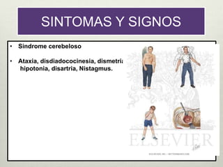 • Sindrome cerebeloso
• Ataxia, disdiadococinesia, dismetria,
hipotonia, disartria, Nistagmus.
SINTOMAS Y SIGNOS
 