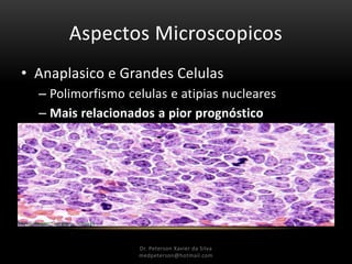Aspectos Microscopicos
• Anaplasico e Grandes Celulas
– Polimorfismo celulas e atipias nucleares
– Mais relacionados a pior prognóstico
Dr. Peterson Xavier da Silva
Dr. Peterson Xavier da Silva
medpeterson@hotmail.com
 