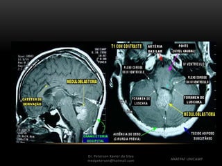 Dr. Peterson Xavier da Silva
Dr. Peterson Xavier da Silva
medpeterson@hotmail.com ANATPAT UNICAMP
 