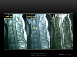Dr. Peterson Xavier da Silva
Dr. Peterson Xavier da Silva
medpeterson@hotmail.com ANATPAT UNICAMP
 