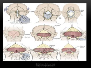 Dr. Peterson Xavier da Silva
medpeterson@hotmail.com
 