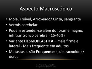 Aspecto Macroscópico
• Mole, Friável, Arroxeado/ Cinza, sangrante
• Vermis cerebelar
• Podem estender-se além do forame magno,
infiltrar tronco cerebral (15-40%)
• Variante DESMOPLASTICA – mais firme e
lateral - Mais frequente em adultos
• Metástases são Frequentes (subaracnoide) /
óssea
Dr. Peterson Xavier da Silva
Dr. Peterson Xavier da Silva
medpeterson@hotmail.com
 