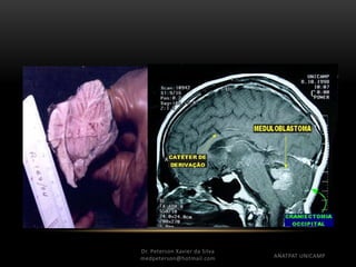 Dr. Peterson Xavier da Silva
medpeterson@hotmail.com ANATPAT UNICAMP
 
