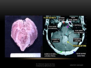 Dr. Peterson Xavier da Silva
medpeterson@hotmail.com ANATPAT UNICAMP
 