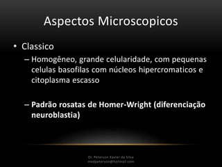 Aspectos Microscopicos
• Classico
– Homogêneo, grande celularidade, com pequenas
celulas basofilas com núcleos hipercromaticos e
citoplasma escasso
– Padrão rosatas de Homer-Wright (diferenciação
neuroblastia)
Dr. Peterson Xavier da Silva
Dr. Peterson Xavier da Silva
medpeterson@hotmail.com
 
