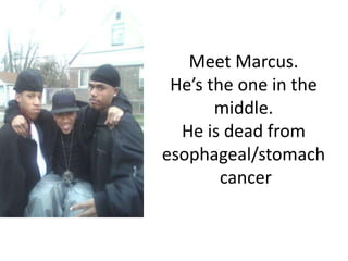 Meet Marcus.
 He’s the one in the
       middle.
  He is dead from
esophageal/stomach
        cancer
 