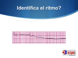 Identifica el ritmo?
 