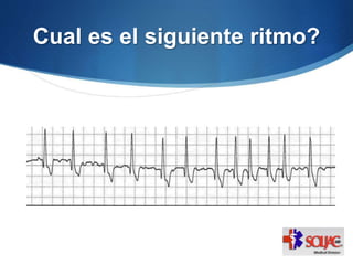 Cual es el siguiente ritmo?
 