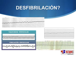 DESFIBRILACIÓN?
 