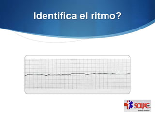 Identifica el ritmo?
 