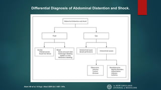 Alam HB et al. N Engl J Med 2009;361:1487-1496.
Differential Diagnosis of Abdominal Distention and Shock.
 