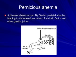 Pernicious anemia
A disease characterized By Gastric parietal atrophy
leading to decreased secretion of intrinsic factor and
other gastric juices.
 