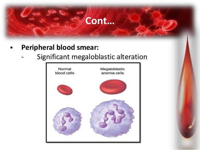 blood mean 3 test Megaloblastic anemia
