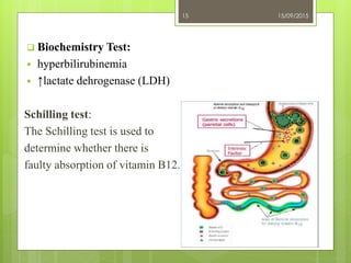  Biochemistry Test:
 hyperbilirubinemia
 ↑lactate dehrogenase (LDH)
Schilling test:
The Schilling test is used to
determine whether there is
faulty absorption of vitamin B12.
15/09/2015
Asogwa Uka
15
 