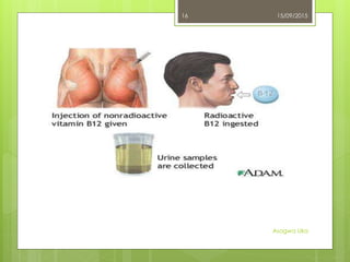 15/09/2015
Asogwa Uka
16
 