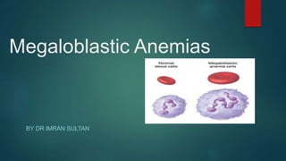Megaloblastic Anemias
BY DR IMRAN SULTAN
 
