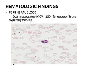 HEMATOLOGIC FINDINGS
• PERIPHERAL BLOOD:
Oval macrocytes(MCV >100) & neutrophils are
hypersegmented
 