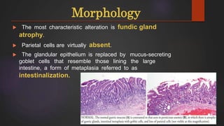 Megaloblastic Anemia | PPTX