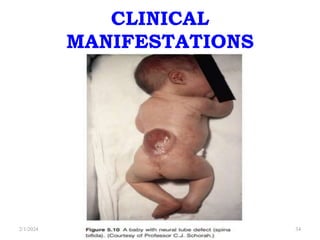 CLINICAL
MANIFESTATIONS
2/1/2024 34
 