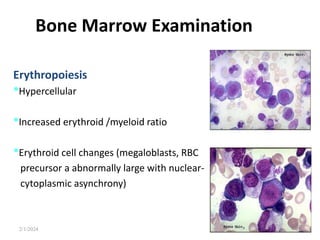 Bone Marrow Examination
Erythropoiesis
•Hypercellular
•Increased erythroid /myeloid ratio
•Erythroid cell changes (megaloblasts, RBC
precursor a abnormally large with nuclear-
cytoplasmic asynchrony)
2/1/2024 42
 