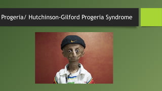 Progeria/ Hutchinson-Gilford Progeria Syndrome
 
