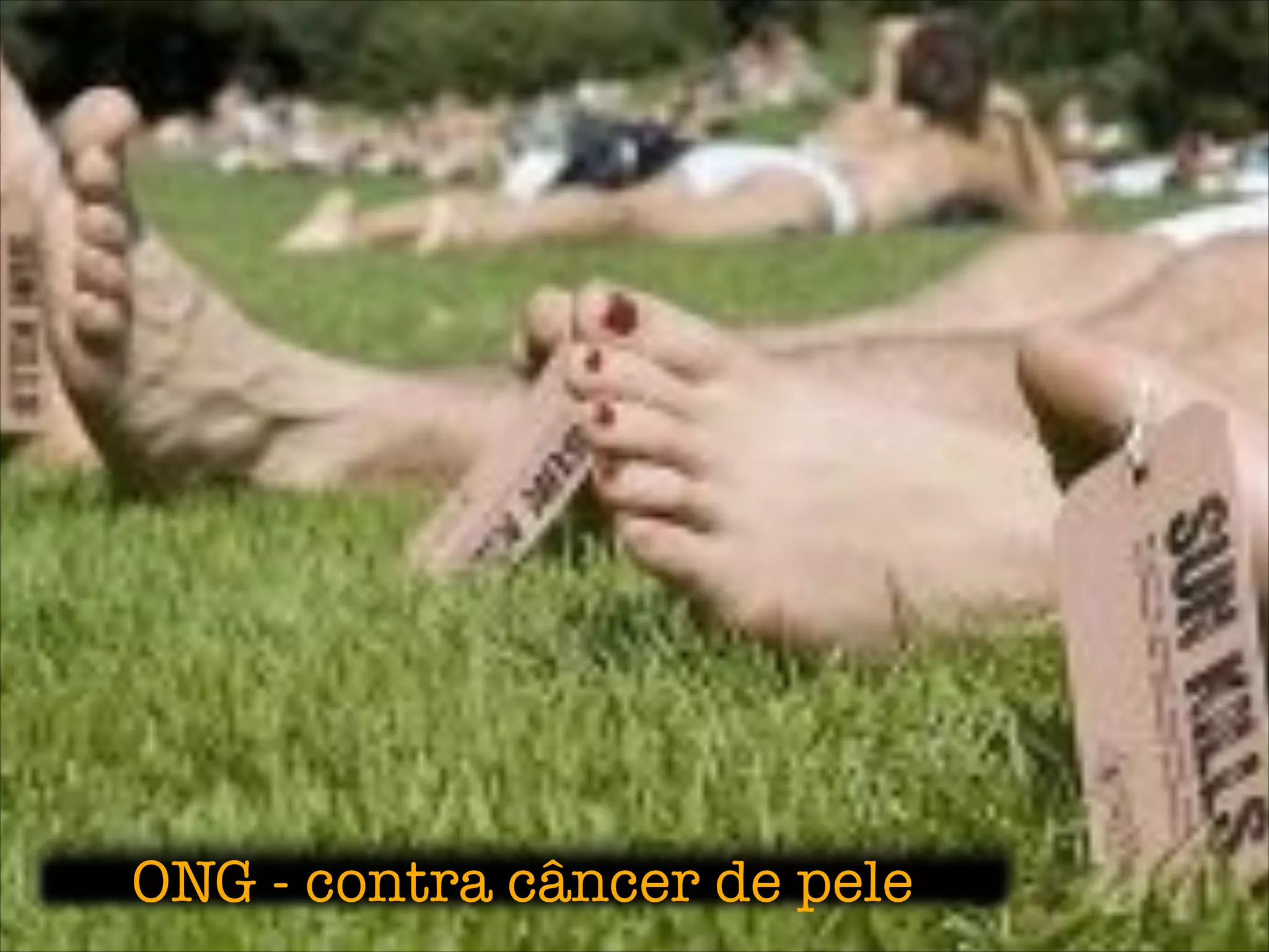 ONG - contra câncer de pele
 