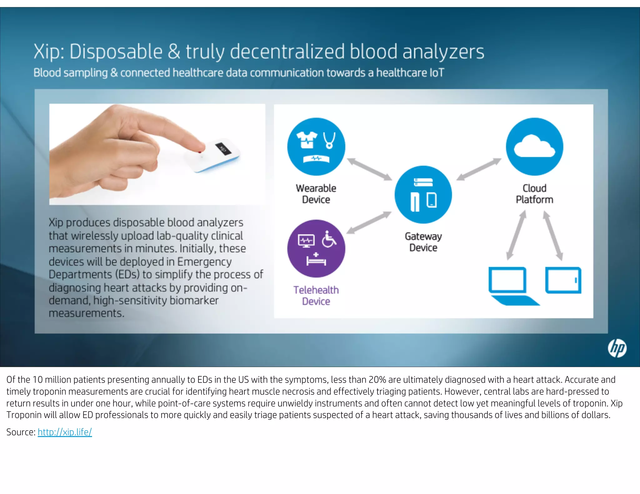 Of the 10 million patients presenting annually to EDs in the US with the symptoms, less than 20% are ultimately diagnosed with a heart attack. Accurate and
timely troponin measurements are crucial for identifying heart muscle necrosis and effectively triaging patients. However, central labs are hard-pressed to
return results in under one hour, while point-of-care systems require unwieldy instruments and often cannot detect low yet meaningful levels of troponin. Xip
Troponin will allow ED professionals to more quickly and easily triage patients suspected of a heart attack, saving thousands of lives and billions of dollars.
Source: http://xip.life/
 