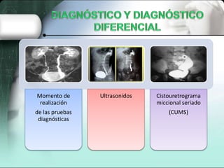 Momento de
realización
de las pruebas
diagnósticas
Ultrasonidos Cistouretrograma
miccional seriado
(CUMS)
 