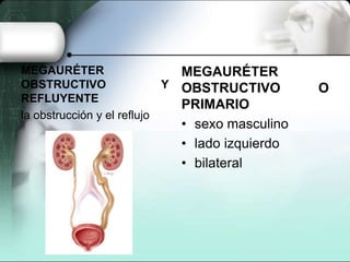 MEGAURÉTER
OBSTRUCTIVO Y
REFLUYENTE
la obstrucción y el reflujo
MEGAURÉTER
OBSTRUCTIVO O
PRIMARIO
• sexo masculino
• lado izquierdo
• bilateral
 